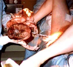 Is it possible to bring the girl to orgasm small penis