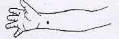 location of Pericardium 6 pressure point